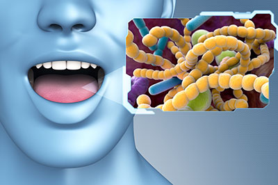 An image featuring a human mouth with a microscopic view of bacteria and viruses displayed on a monitor or screen, set against a blue background.
