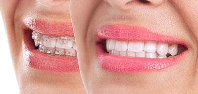 Close-up of a person s smiling face with pink lipstick, showcasing teeth and lips.