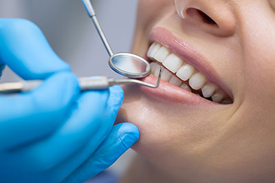 A dental professional performing a teeth cleaning procedure on a patient, with a focus on the dental tools and the patient s mouth.