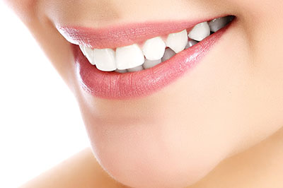 The image shows a close-up of a person s face, focusing on their smile and teeth.