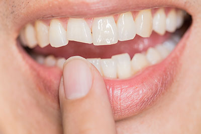 Smiling person holding a toothbrush to their mouth, emphasizing dental hygiene.