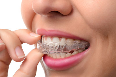 The image shows a person with a mouth full of dental floss, holding it up to their teeth.