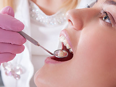 A woman receiving dental treatment, with a dental professional using a drill on her teeth.